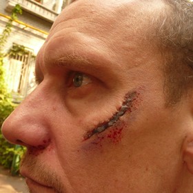 Грим: Шрамы, Синяки, Ссадины